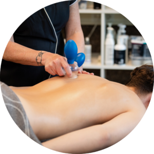 Cuppingmassage bij Beautysalon Hilberma in Beilen