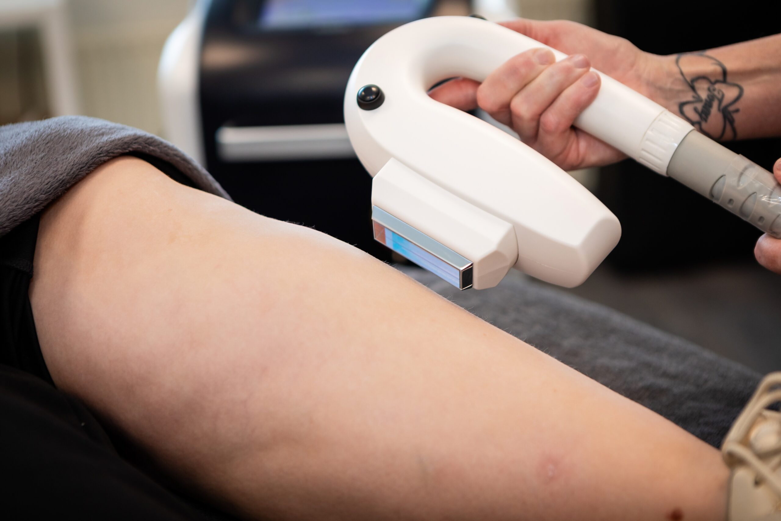 IPL ontharen bij Beautysalon Hilberma in Beilen voor langdurige haarreductie en een gladde, haarvrije huid.